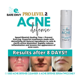 ACNE DEFENSE CORRECTING SERUM